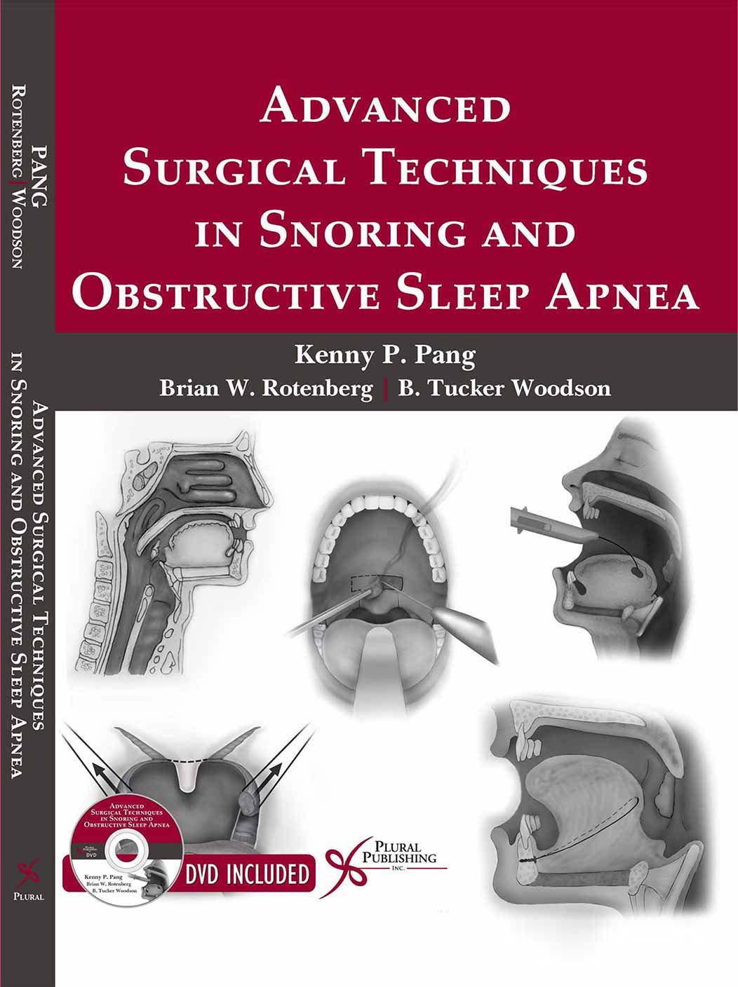 Advanced-Surgical-Techniques-in-Snoring-Obstructive-Sleep-Apnea-Book-Cover